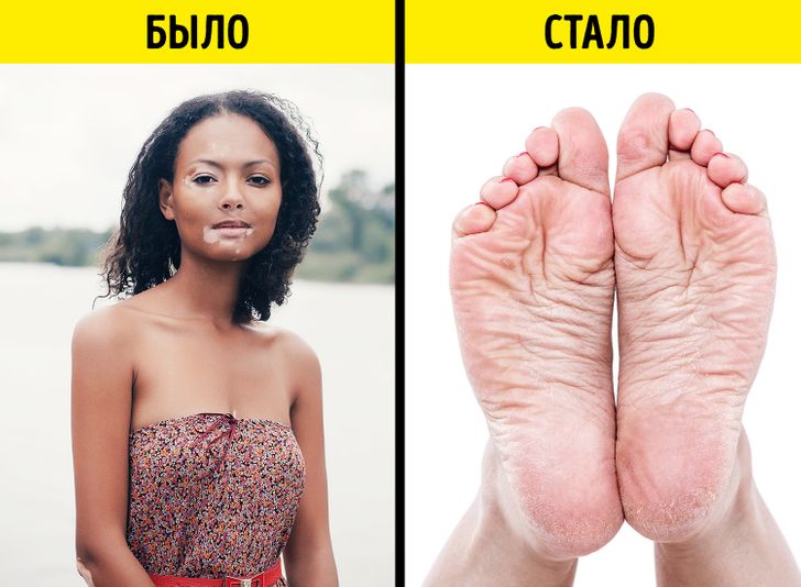 Что такое бодипозитив: определение понятия простыми словами и суть движения