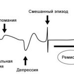 Что такое гипомания: определение понятия, симптомы, признаки и суть психического расстройства