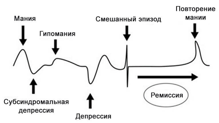 Что такое гипомания: определение понятия, симптомы, признаки и суть психического расстройства