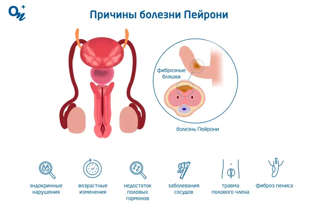 Что такое минет: определение, суть процесса, виды и советы как правильно делать