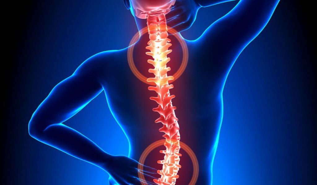 Остеохондроз позвоночника: современный взгляд на проблему