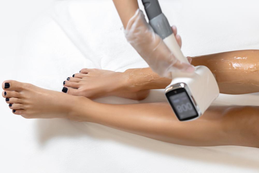 Лазерна епіляція ніг: міфи, обмеження та правила безпеки