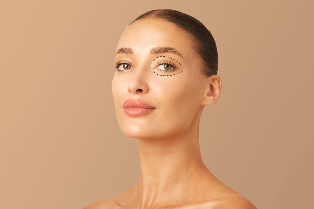 Міфи про блефаропластику, які потрібно знати кожному